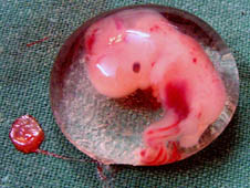 a six week old human embryo