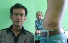 Indonesian family threatened over torture claims