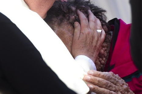 Pope's compassionate embrace for severely disfigured man
